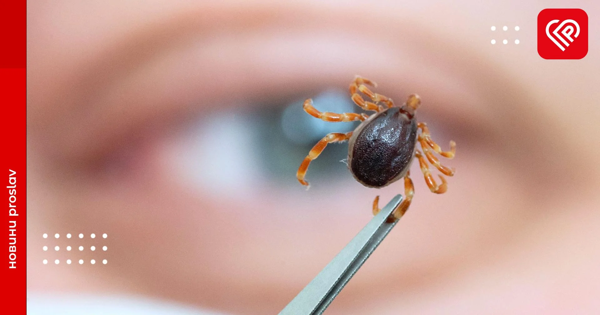 Як видалити кліща без лікаря: дієві поради від біолога