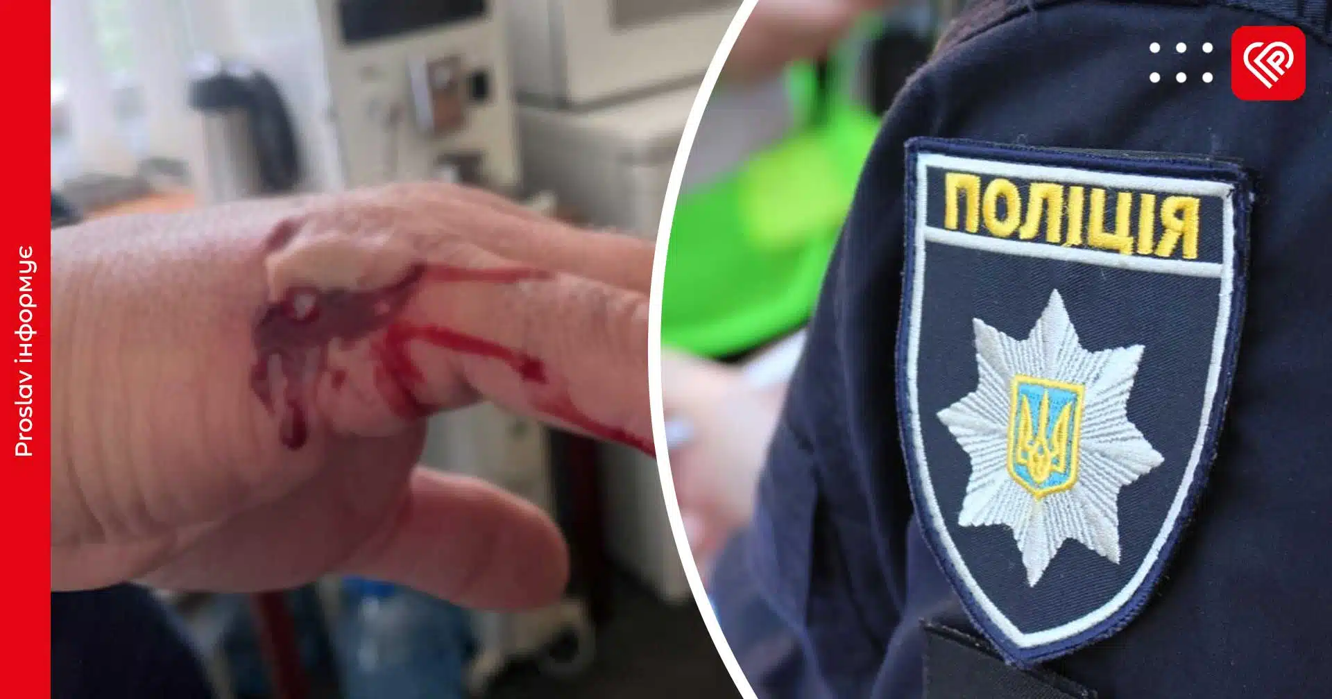 Активістка вкусила міського голову Переяслава: мер вакцинувався, поліція відкрила справу