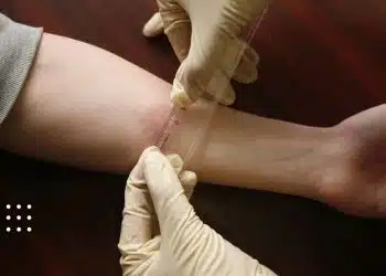 проба манту